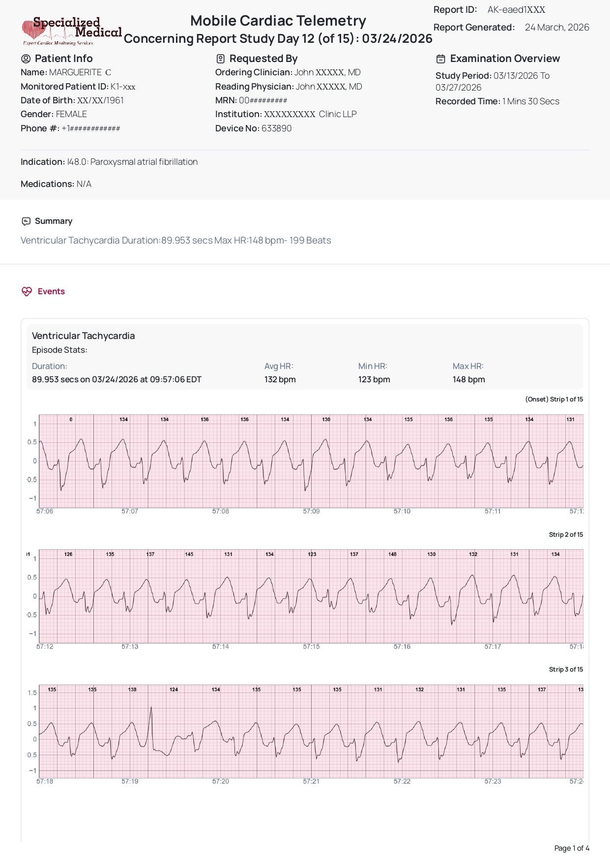 S-Patch cardiac monitor detecting serious rhythm issue