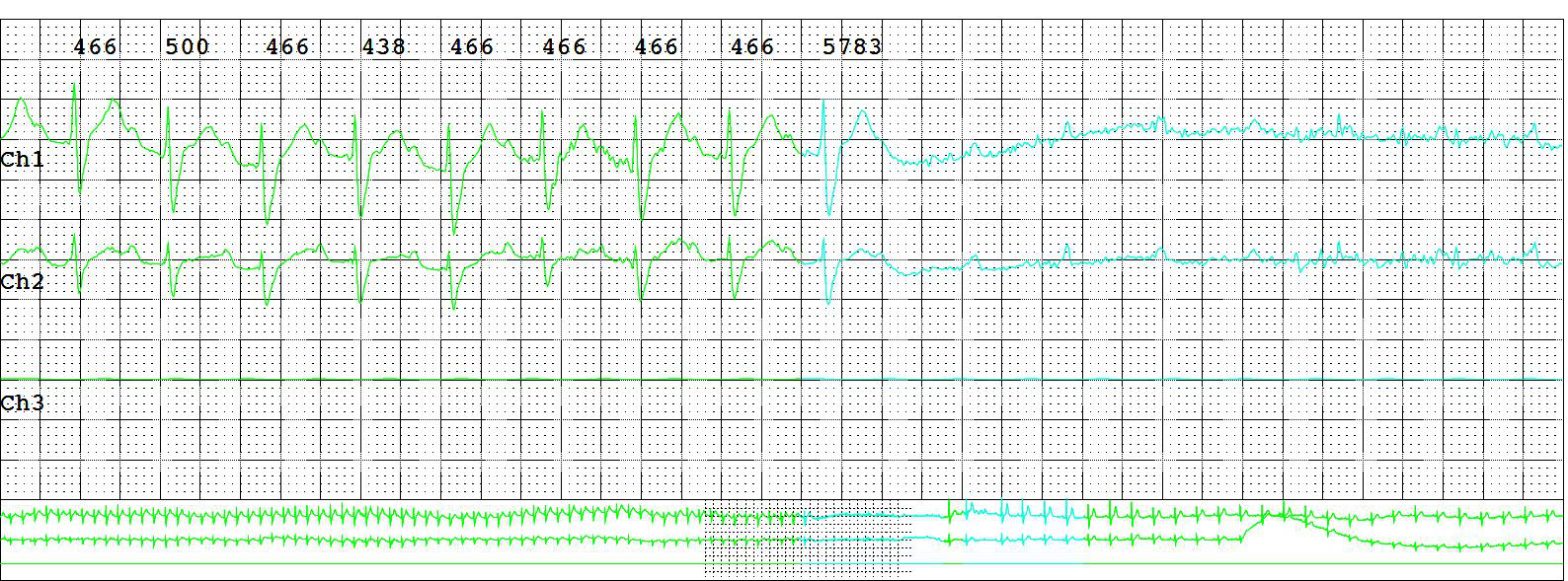 Physician reviewing Holter monitor results from Specialized Medical