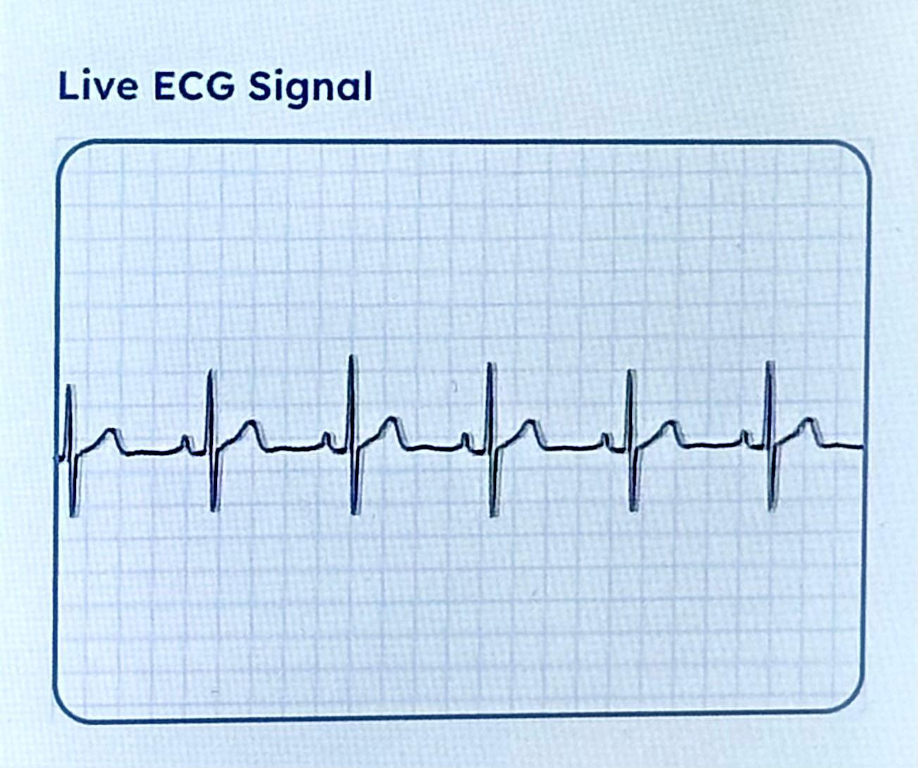 Cardiac Wire interview with Steven M. Burns, President & CEO of Specialized Medical, discussing live-streaming ECG technology and ambulatory cardiac monitoring services.